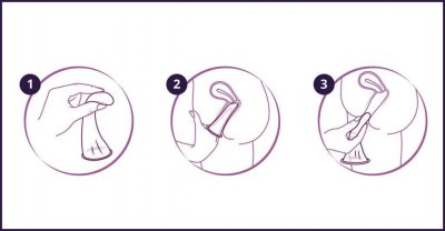 Drei Piktogramme über die Positionierun eines Femidoms - Kondoms für Frauen - in der Scheide