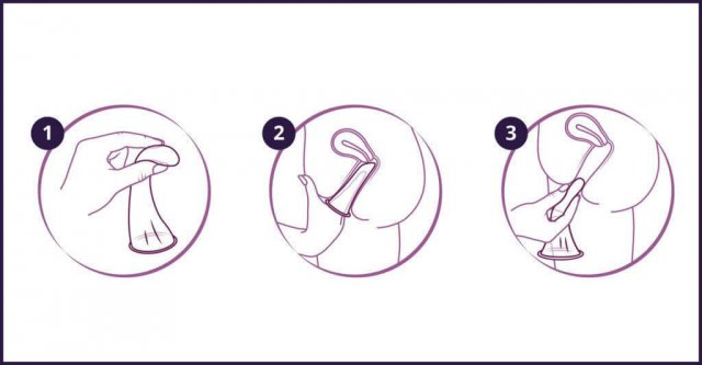 Drei Piktogramme über die Positionierun eines Femidoms - Kondoms für Frauen - in der Scheide