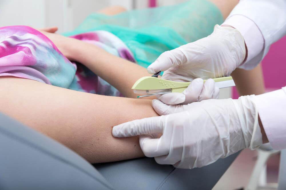 Wie viel kostet ein Hormonimplantat? Wie viel kostet ein Hormonimplantat?